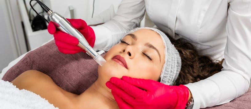 Microneedling Certificate. Female client receiving a Microneedling treatment on her face.